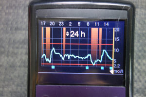 Minimed 640g insulin pump graph
