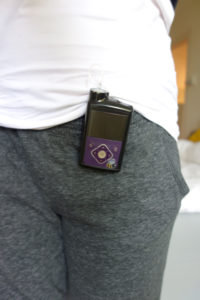 minimed 640g insulin pump clipped on trousers sleeping with diabetes